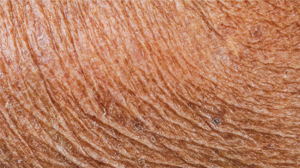 closeup of human skin with incorrect PH balance